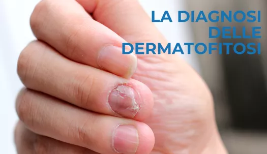 Dermatofiti